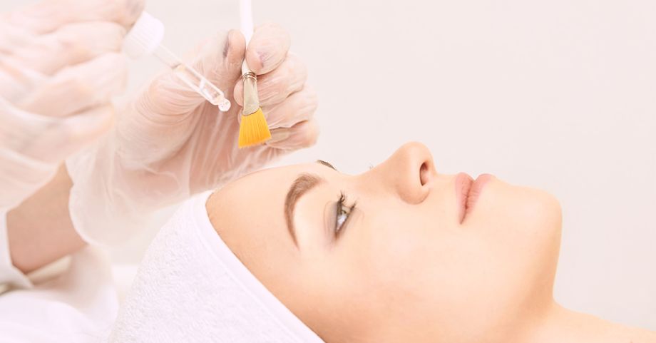 chemical peel expectations