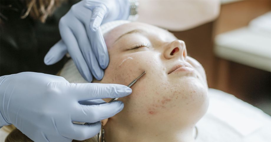 Dermaplaning at Tru Glo Medspa