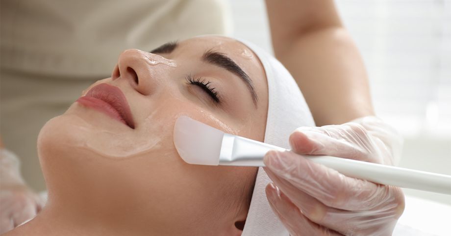 questions about chemical peels