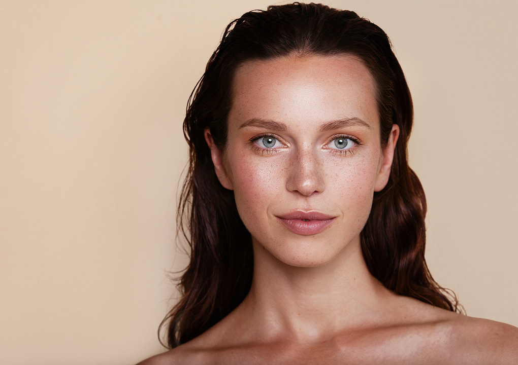 Skin laxity